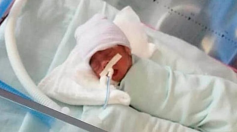 El pequeño Ángel David fue hospitalizado durante tres meses en el IMSS, ya que nació de seis meses (Foto: Cortesía)